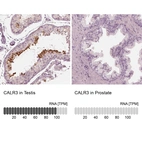 Anti-CALR3 Antibody