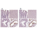 Immunohistochemical staining of human colon, liver, prostate and testis using Anti-CALR3 antibody HPA048460 (A) shows similar protein distribution across tissues to independent antibody HPA043355 (B).