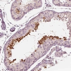 Immunohistochemical staining of human testis shows strong cytoplasmic positivity in spermatids.