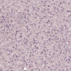 Immunohistochemical staining of human liver shows no positivity in hepatocytes as expected.
