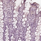 Immunohistochemical staining of human colon shows no positivity in glandular cells as expected.