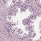 Immunohistochemical staining of human prostate shows no positivity in glandular cells as expected.