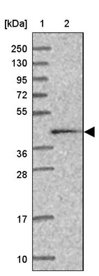 Anti-CALR3 Antibody