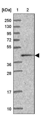 Lane 1: Marker [kDa] 250, 130, 95, 72, 55, 36, 28, 17, 10_br/_Lane 2: Human cell line RT-4