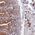 Anti-NLRP6 Antibody