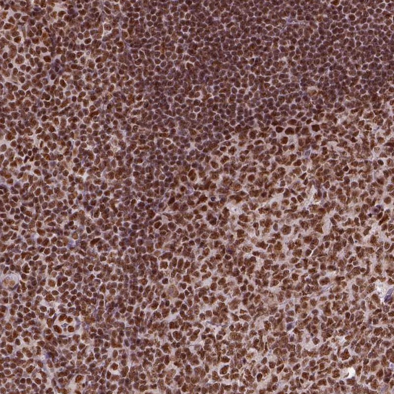 Anti-CCAR1 Antibody