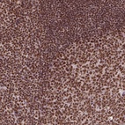 Anti-CCAR1 Antibody