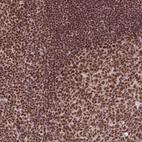 Anti-CCAR1 Antibody