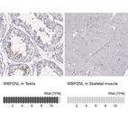 Anti-WBP2NL Antibody