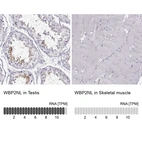 Anti-WBP2NL Antibody