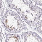 Immunohistochemical staining of human testis shows high expression.