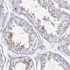 Immunohistochemical staining of human testis shows high expression.