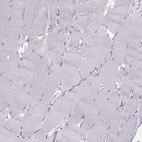 Immunohistochemical staining of human skeletal muscle shows low expression as expected.