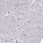 Immunohistochemical staining of human skeletal muscle shows low expression as expected.