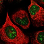 Immunofluorescent staining of human cell line U-2 OS shows localization to nucleus & nucleoli.
