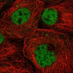 Immunofluorescent staining of human cell line A-431 shows localization to nucleoplasm.