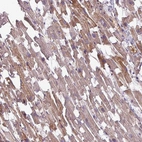 Anti-TMEM178B Antibody