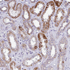 Immunohistochemical staining of human kidney shows strong granular cytoplasmic positivity in cells in tubules.