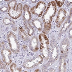 Immunohistochemical staining of human kidney shows strong granular cytoplasmic positivity in cells in tubules.