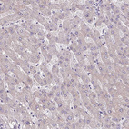Immunohistochemical staining of human liver shows no positivity in hepatocytes as expected.