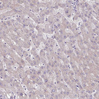 Anti-TMEM178B Antibody
