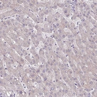 Immunohistochemical staining of human liver shows no positivity in hepatocytes as expected.