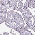 Immunohistochemical staining of human placenta shows no positivity in trophoblastic cells as expected.