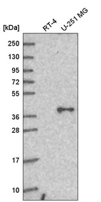 Western blot analysis in human cell line RT-4 and human cell line U-251 MG.
