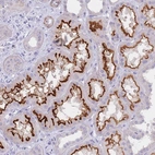 Anti-CHSY1 Antibody