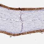 Immunohistochemical staining of human epididymis shows strong cytoplasmic positivity in glandular cells.