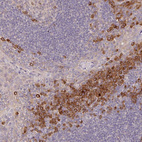 Anti-DERL2 Antibody