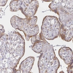 Immunohistochemical staining of human placenta shows moderate cytoplasmic positivity in trophoblastic cells.