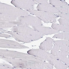 Immunohistochemical staining of human skeletal muscle shows no positivity in myocytes as expected.