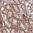 Anti-DCAF12L2 Antibody