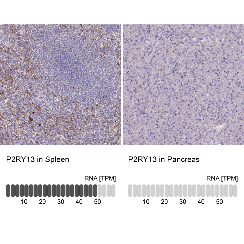 Anti-P2RY13 Antibody
