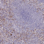 Immunohistochemical staining of human spleen shows moderate to strong cytoplasmic positivity in cells in red pulp.