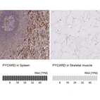 Anti-PYCARD Antibody