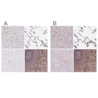 Immunohistochemical staining of human liver, lung, skeletal muscle and spleen using Anti-PYCARD antibody HPA049074 (A) shows similar protein distribution across tissues to independent antibody HPA054496 (B).