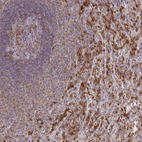 Immunohistochemical staining of human spleen shows strong cytoplasmic positivity in cells in red pulp.