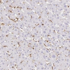 Immunohistochemical staining of human liver shows moderate cytoplasmic positivity in Kupffer cells.