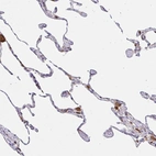 Immunohistochemical staining of human lung shows moderate cytoplasmic positivity in macrophages.