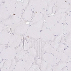 Immunohistochemical staining of human skeletal muscle shows low positivity in myocytes as expected.