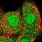 Immunofluorescent staining of human cell line MCF7 shows localization to nucleus, nucleoli & cytosol.