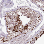 Immunohistochemical staining of human testis shows strong nuclear positivity in cells in seminiferous ducts.