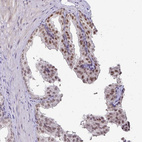 Immunohistochemical staining of human prostate shows moderate nuclear positivity in glandular cells.