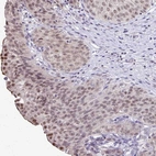 Immunohistochemical staining of human urinary bladder shows moderate nuclear positivity in urothelial cells.
