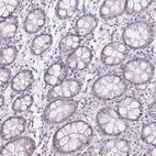 Immunohistochemical staining of human colon shows no positivity in glandular cells as expected,