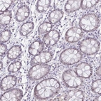 Immunohistochemical staining of human colon shows no positivity in glandular cells as expected,