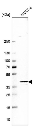 Western blot analysis in human cell line MOLT-4.