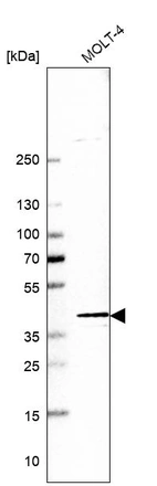 Western blot analysis in human cell line MOLT-4.